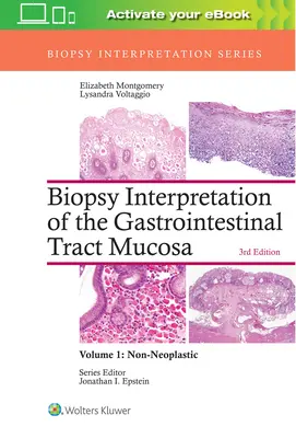 Biopsie-Interpretation der Schleimhaut des Gastrointestinaltraktes: Band 1: Nicht-neoplastisch - Biopsy Interpretation of the Gastrointestinal Tract Mucosa: Volume 1: Non-Neoplastic