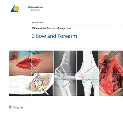 Ao Manual of Fracture Management - Ellenbogen und Unterarm - Ao Manual of Fracture Management - Elbow & Forearm