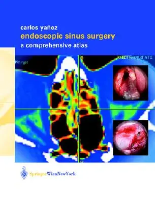 Endoskopische Sinus-Chirurgie: Ein umfassender Atlas - Endoscopic Sinus Surgery: A Comprehensive Atlas
