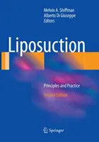 Fettabsaugung: Prinzipien und Praxis - Liposuction: Principles and Practice