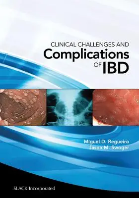 Klinische Herausforderungen und Komplikationen von Ibd - Clinical Challenges and Complications of Ibd