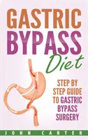 Magenbypass-Diät: Schritt-für-Schritt-Anleitung zur Magenbypass-Operation - Gastric Bypass Diet: Step By Step Guide to Gastric Bypass Surgery