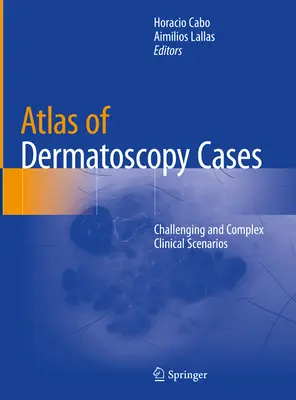 Atlas der Dermatoskopie-Fälle: Anspruchsvolle und komplexe klinische Szenarien - Atlas of Dermatoscopy Cases: Challenging and Complex Clinical Scenarios