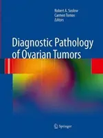Diagnostische Pathologie von Eierstocktumoren - Diagnostic Pathology of Ovarian Tumors