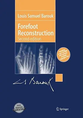 Rekonstruktion des Vorderfußes - Forefoot Reconstruction