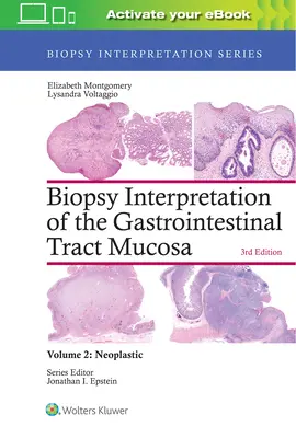 Interpretation der Biopsie der Schleimhaut des Gastrointestinaltrakts: Band 2: Neoplastisch - Biopsy Interpretation of the Gastrointestinal Tract Mucosa: Volume 2: Neoplastic