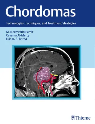 Chordome: Technologien, Techniken und Behandlungsstrategien - Chordomas: Technologies, Techniques, and Treatment Strategies