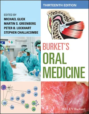 Burket's Orale Medizin - Burket's Oral Medicine