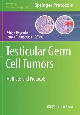 Hoden-Keimzelltumore: Methoden und Protokolle - Testicular Germ Cell Tumors: Methods and Protocols