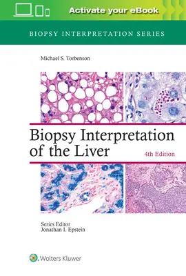 Biopsie-Interpretation der Leber - Biopsy Interpretation of the Liver