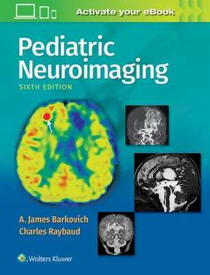 Pädiatrische Neurobildgebung - Pediatric Neuroimaging