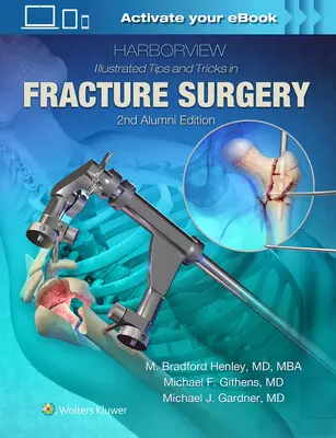 Harborview Illustrierte Tipps und Tricks in der Frakturchirurgie - Harborview Illustrated Tips and Tricks in Fracture Surgery