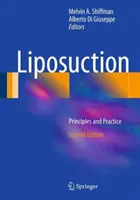 Fettabsaugung: Grundsätze und Praxis - Liposuction: Principles and Practice