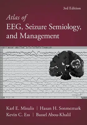 Atlas des EEG, der Anfallssemiologie und des Managements - Atlas of Eeg, Seizure Semiology, and Management