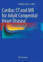 Kardiales CT und MR bei angeborenen Herzfehlern bei Erwachsenen - Cardiac CT and MR for Adult Congenital Heart Disease