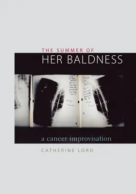 Der Sommer ihrer Kahlheit: Eine Krebsimprovisation - The Summer of Her Baldness: A Cancer Improvisation