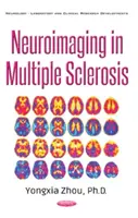 Neuroimaging bei Multipler Sklerose - Neuroimaging in Multiple Sclerosis