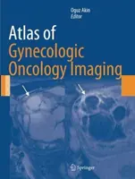 Atlas der gynäkologischen onkologischen Bildgebung - Atlas of Gynecologic Oncology Imaging