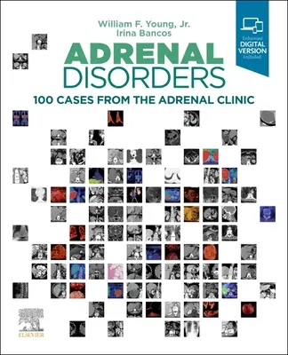 Erkrankungen der Nebenniere: 100 Fälle aus der Nebennierenklinik - Adrenal Disorders: 100 Cases from the Adrenal Clinic