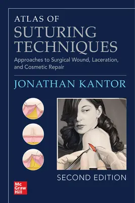 Atlas der Nahttechniken: Ansätze zur chirurgischen Wund-, Schnittwunden- und kosmetischen Reparatur, Zweite Auflage - Atlas of Suturing Techniques: Approaches to Surgical Wound, Laceration, and Cosmetic Repair, Second Edition