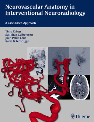 Neurovaskuläre Anatomie in der Interventionellen Neuroradiologie: Ein fallbasierter Ansatz - Neurovascular Anatomy in Interventional Neuroradiology: A Case-Based Approach