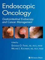 Endoskopische Onkologie - Endoscopic Oncology