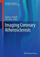 Bildgebung der koronaren Atherosklerose - Imaging Coronary Atherosclerosis