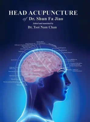 Kopf-Akupunktur von Dr. Shun Fa Jiao - Head Acupuncture of Dr. Shun Fa Jiao