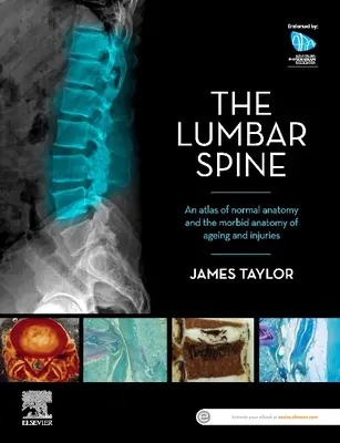 Die Lendenwirbelsäule: Ein Atlas der normalen Anatomie und der krankhaften Anatomie des Alterns und der Verwundung - The Lumbar Spine: An Atlas of Normal Anatomy and the Morbid Anatomy of Ageing and Injury