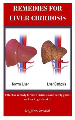 Heilmittel für Leberzirrhose: Wirksame Mittel gegen Leberzirrhose und Sicherheitshinweise zum Vorgehen - Remedies For Liver Cirrhosis: Effective remedies for liver cirrhosis and safety guide on how to go about it