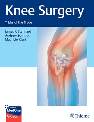 Kniechirurgie: Tricks des Handwerks - Knee Surgery: Tricks of the Trade
