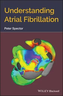 Vorhofflimmern verstehen - Understanding Atrial Fibrillation