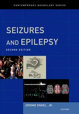 Krampfanfälle und Epilepsie - Seizures and Epilepsy