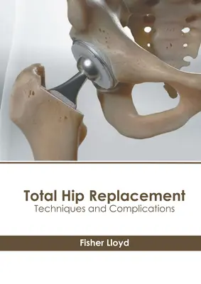 Totaler Hüftgelenkersatz: Techniken und Komplikationen - Total Hip Replacement: Techniques and Complications