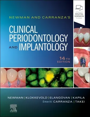 Klinische Parodontologie und Implantologie von Newman und Carranza - Newman and Carranza's Clinical Periodontology and Implantology