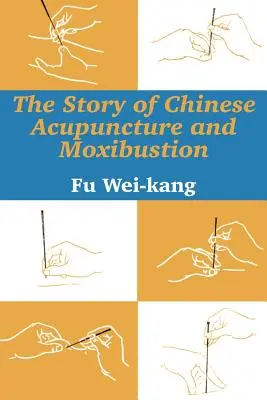 Die Geschichte der chinesischen Akupunktur und Moxibustion - The Story of Chinese Acupuncture and Moxibustion