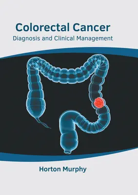 Kolorektaler Krebs: Diagnose und klinisches Management - Colorectal Cancer: Diagnosis and Clinical Management