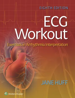 EKG-Training: Übungen zur Interpretation von Herzrhythmusstörungen - ECG Workout: Exercises in Arrhythmia Interpretation