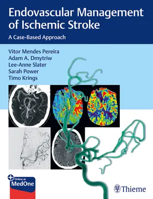 Endovaskuläres Management des ischämischen Schlaganfalls: Ein fallbasierter Ansatz - Endovascular Management of Ischemic Stroke: A Case-Based Approach