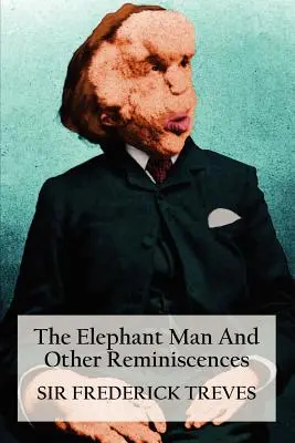 Der Elefantenmensch und andere Reminiszenzen - The Elephant Man and Other Reminiscences