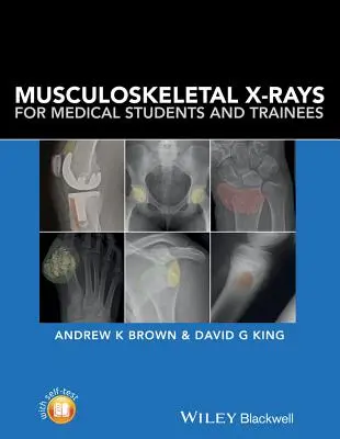 Muskuloskelettale Röntgenbilder für Medizinstudenten und Auszubildende - Musculoskeletal X-Rays for Medical Students and Trainees