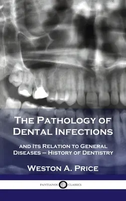 Pathologie der Zahninfektionen: und ihre Beziehung zu den allgemeinen Krankheiten - Geschichte der Zahnmedizin - Pathology of Dental Infections: and Its Relation to General Diseases - History of Dentistry
