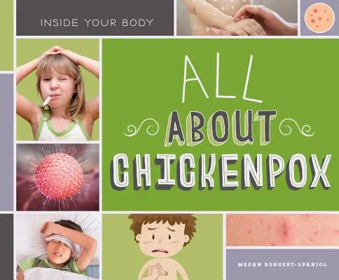 Alles über Windpocken - All about Chickenpox