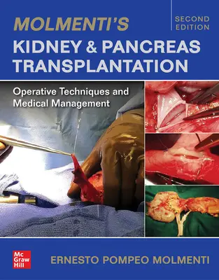 Molmenti's Nieren- und Pankreastransplantation: Operative Techniken und medizinisches Management - Molmenti's Kidney and Pancreas Transplantation: Operative Techniques and Medical Management