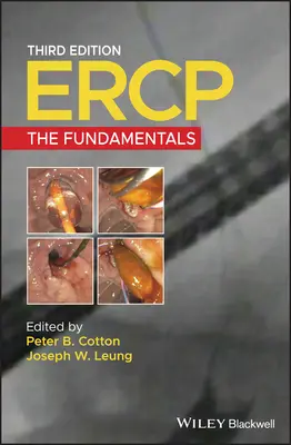 Ercp: Die Grundlagen - Ercp: The Fundamentals