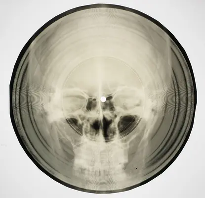 Knochenmusik: Sowjetisches Röntgen-Audio - Bone Music: Soviet X-Ray Audio