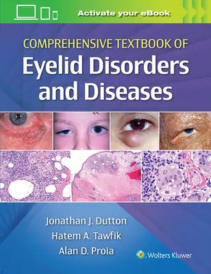 Umfassendes Lehrbuch der Augenlidstörungen und -krankheiten - Comprehensive Textbook of Eyelid Disorders and Diseases