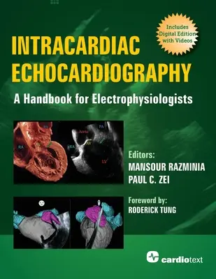 Intrakardiale Echokardiographie: Ein Handbuch für Elektrophysiologen - Intracardiac Echocardiography: A Handbook for Electrophysiologists