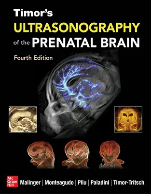 Timor's Ultraschall des pränatalen Gehirns, Vierte Auflage - Timor's Ultrasonography of the Prenatal Brain, Fourth Edition