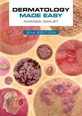 Dermatologie leicht gemacht, Zweite Auflage - Dermatology Made Easy, Second Edition